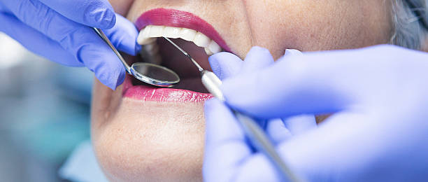 Best Emergency Dental Care for Trauma or Injury in Lake Clarke Shores, FL